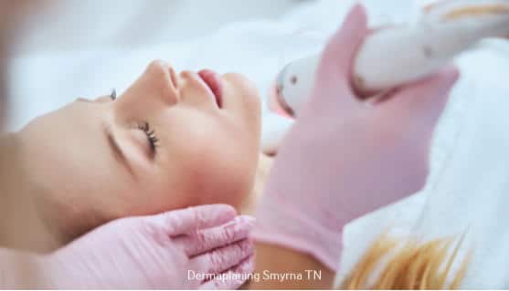 Dermaplaning Smyrna TN 2