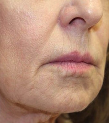 After Image: Secret RF - right-front-oblique