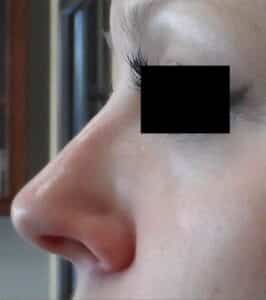 After Image: Secret RF