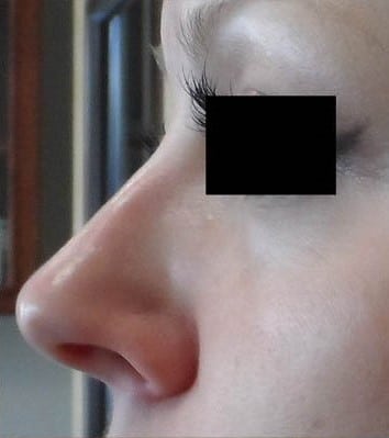 After Image: Secret RF - left-side