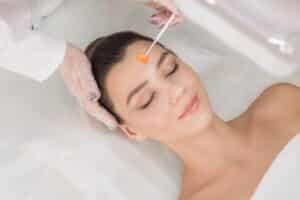 Chemical Peel Frequency Smyrna TN