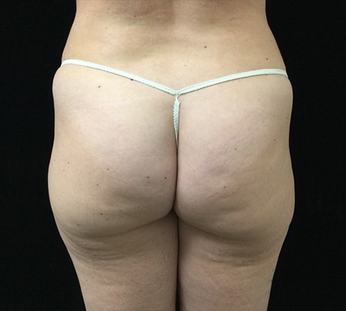 Before Image: Attiva - back