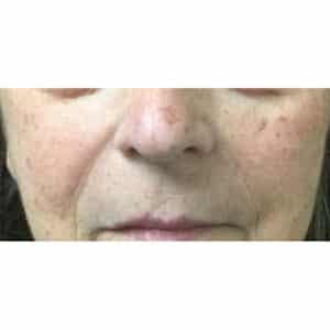 Before Image: IPL