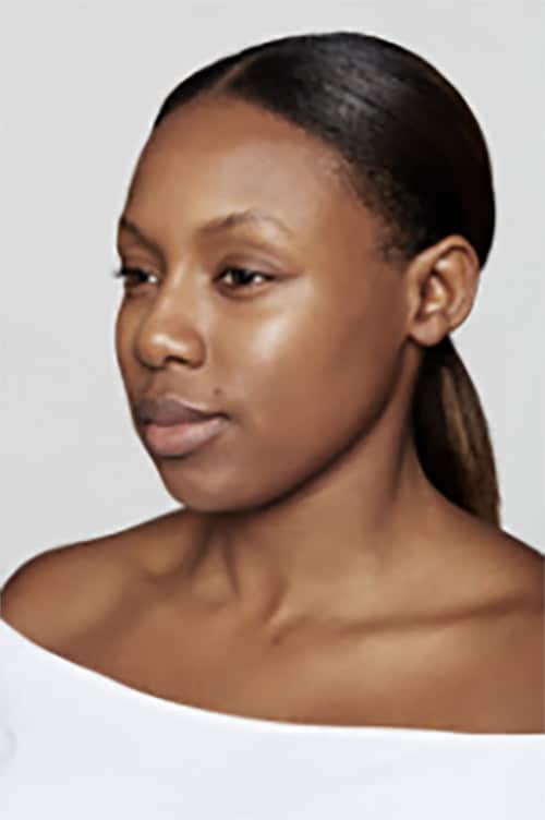 After Image: Dysport - left-front-oblique