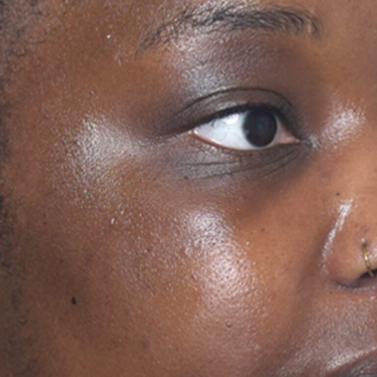 After Image: Hydrafacial - right-front-oblique