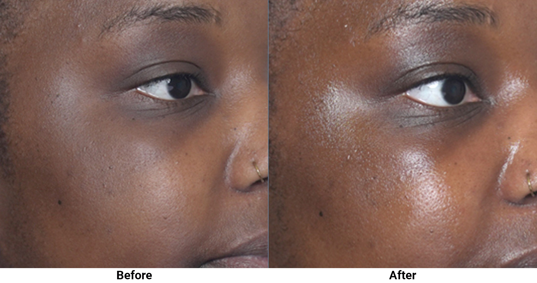 125871 hydrafacial feat