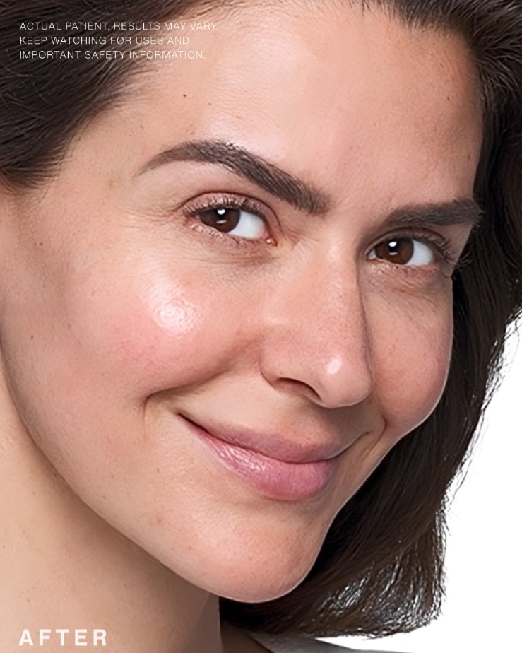 After Image: Skinvive - right-front-oblique